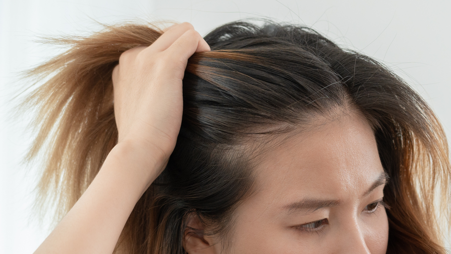 Chute de cheveux : causes, solutions et routine anti-chute naturelle
