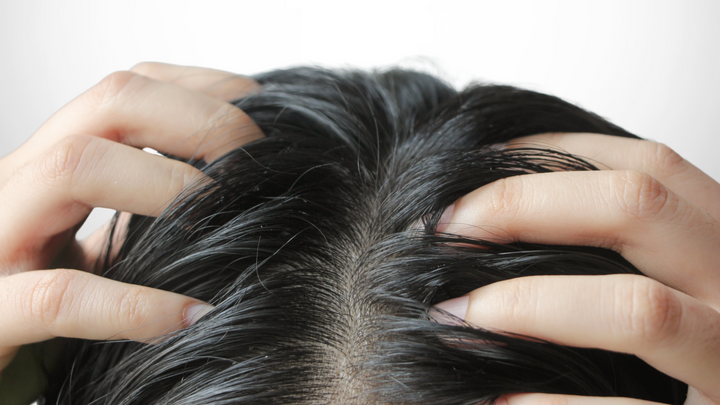 Comment faire pour ne plus avoir les cheveux gras ?