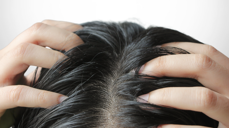 Comment faire pour ne plus avoir les cheveux gras ?