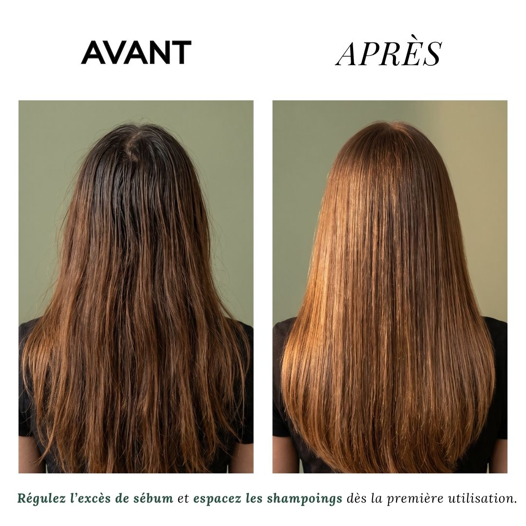 Shampoing Cheveux Gras